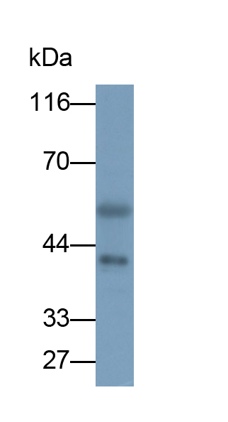 Polyclonal Antibody to Tropomodulin 1 (TMOD1)