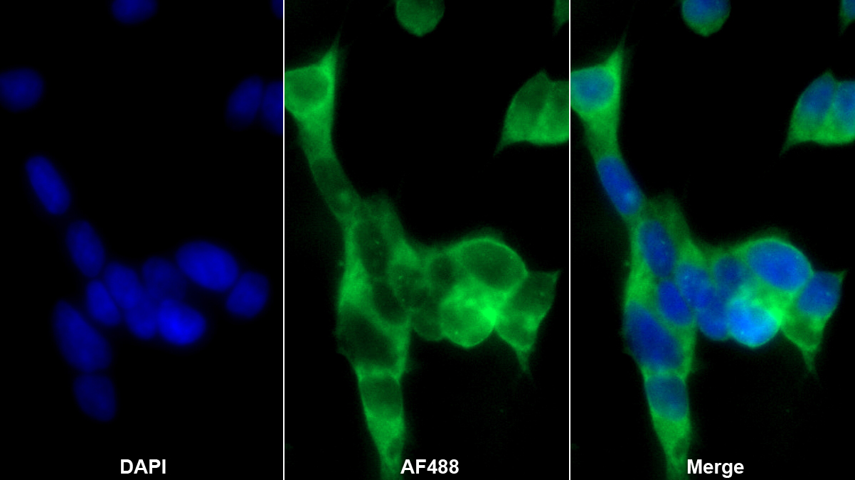 Polyclonal Antibody to Tropomodulin 1 (TMOD1)