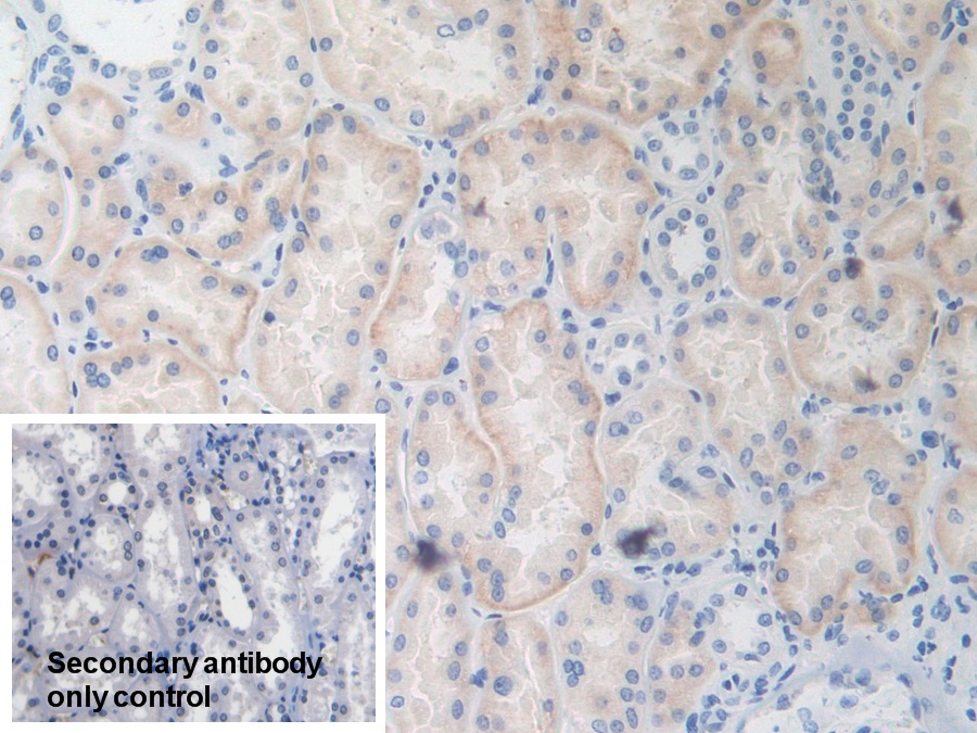 Polyclonal Antibody to TNF Receptor Associated Factor 4 (TRAF4)