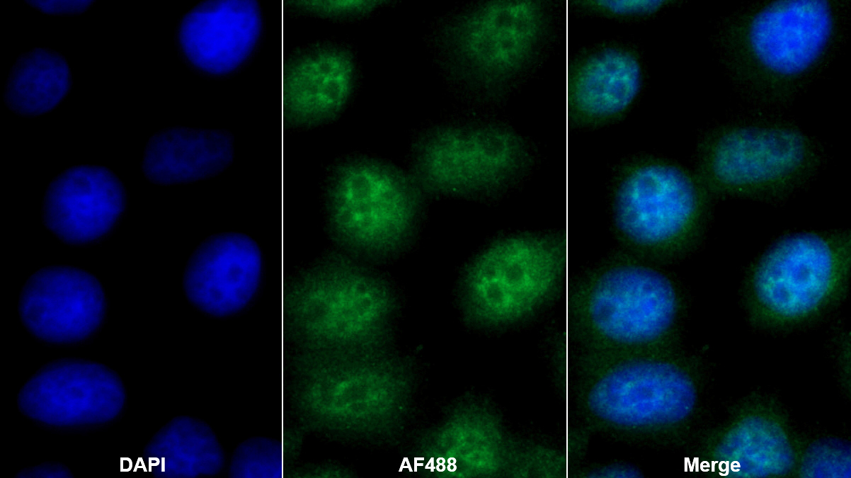 Polyclonal Antibody to Transcription Termination Factor, RNA polymerase I (TTF1)