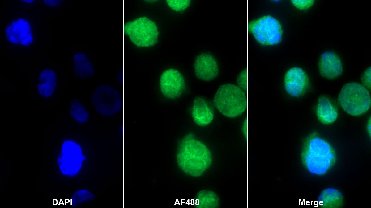 Polyclonal Antibody to NK6 Homeobox Protein 1 (NKX6-1)