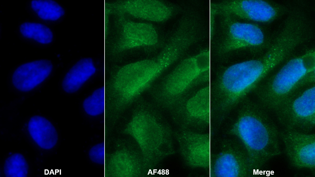 Polyclonal Antibody to NK6 Homeobox Protein 1 (NKX6-1)