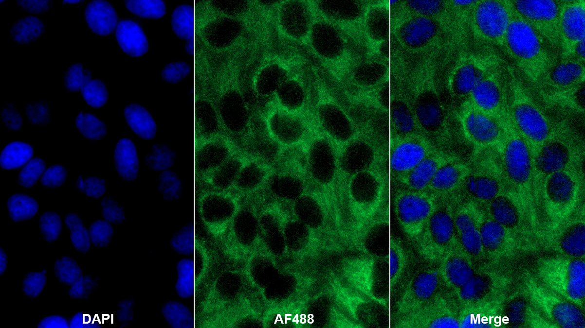 Polyclonal Antibody to Polyribonucleotide Nucleotidyltransferase 1 (PNPT1)