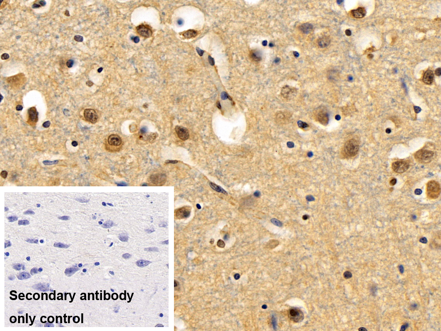 Polyclonal Antibody to Cold Inducible RNA Binding Protein (CIRBP)