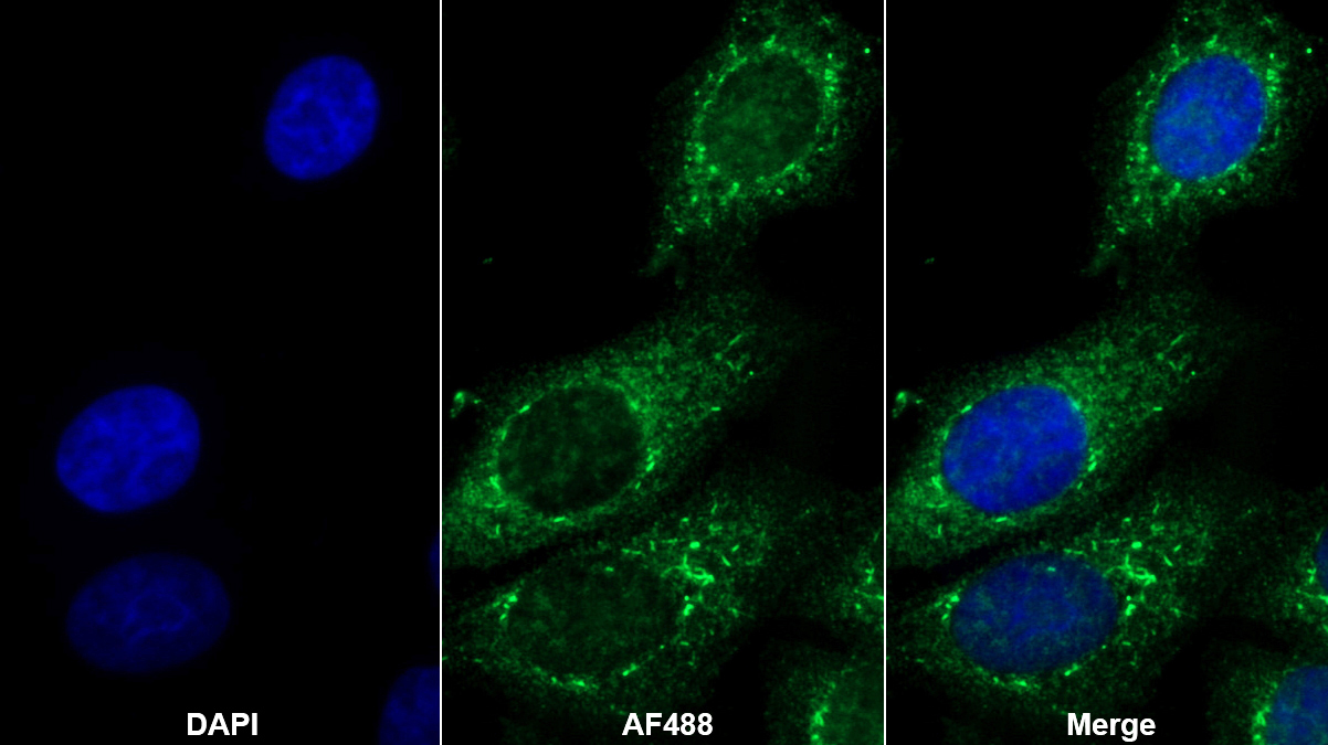 Polyclonal Antibody to Voltage Dependent Anion Channel Protein 1 (VDAC1)