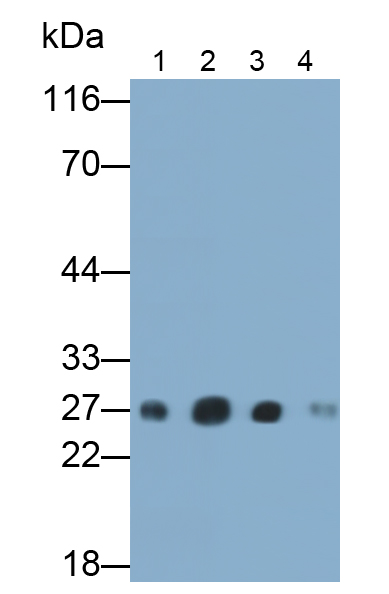 Polyclonal Antibody to Ubiquitin Carboxyl Terminal Hydrolase L1 (UCHL1)