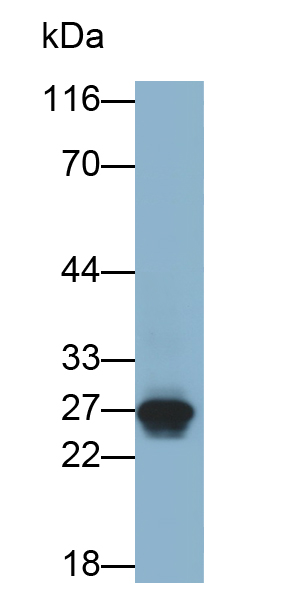 Polyclonal Antibody to Ubiquitin Carboxyl Terminal Hydrolase L1 (UCHL1)