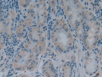 Polyclonal Antibody to Glutaredoxin 3 (GLRX3)