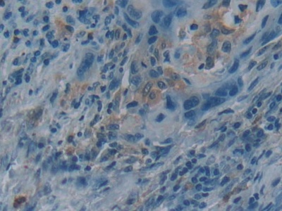 Polyclonal Antibody to Glutaredoxin 3 (GLRX3)