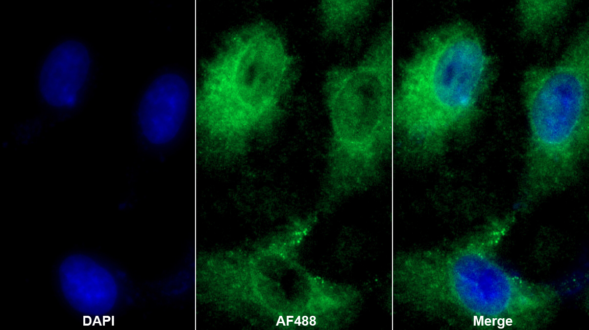 Polyclonal Antibody to Transforming Growth Factor Beta 1 Induced Transcript 1 (TGFb1I1)