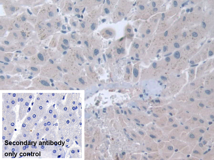 Polyclonal Antibody to Stress Induced Phosphoprotein 1 (STIP1)