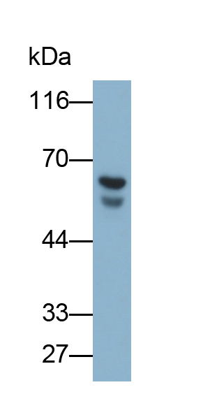 Polyclonal Antibody to Squalene Epoxidase (SQLE)