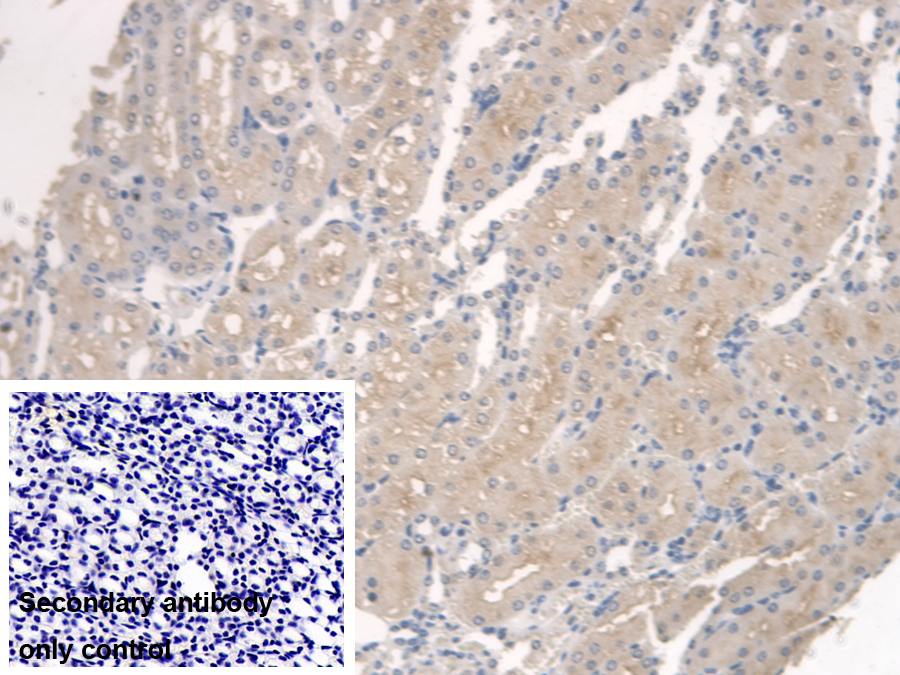 Polyclonal Antibody to Serine Palmitoyltransferase, Long Chain Base Subunit 1 (SPTLC1)