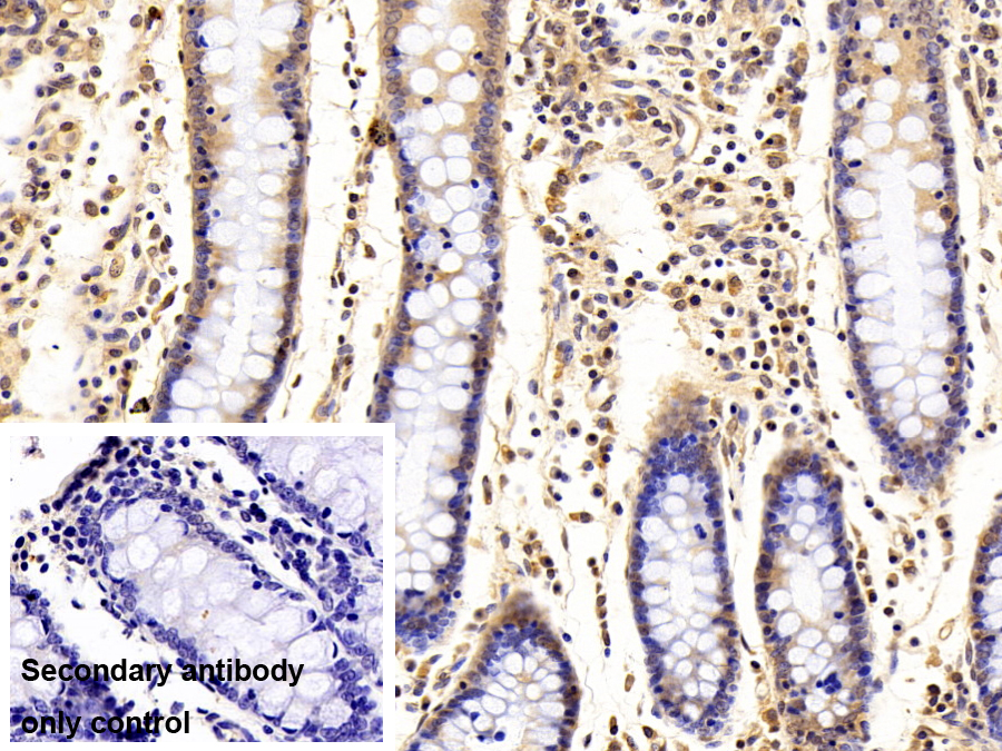 Polyclonal Antibody to SET Binding Protein 1 (SETBP1)