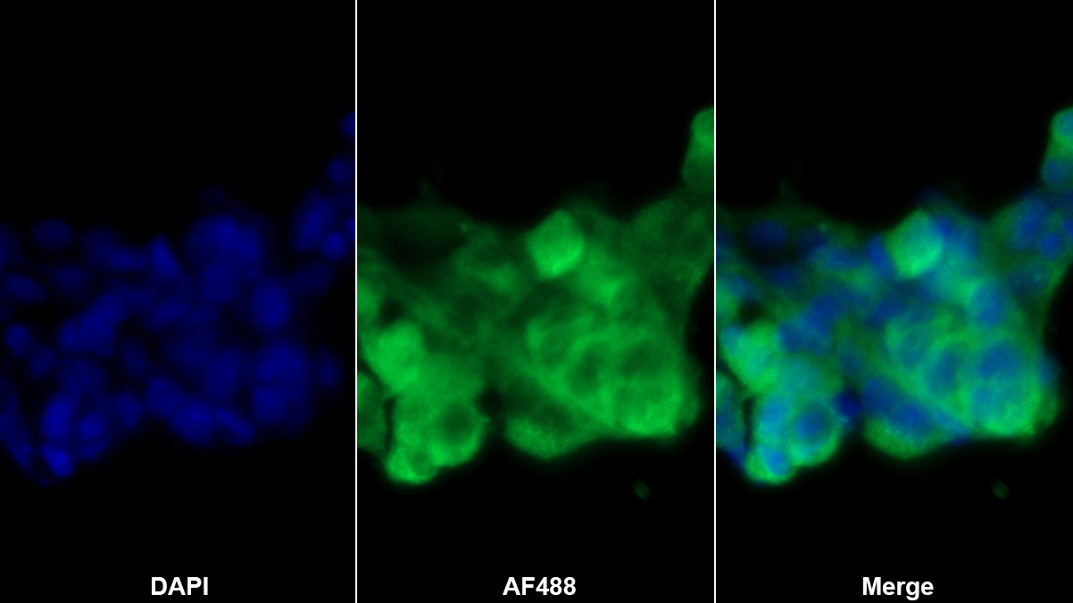 Polyclonal Antibody to RalA Binding Protein 1 (RALBP1)
