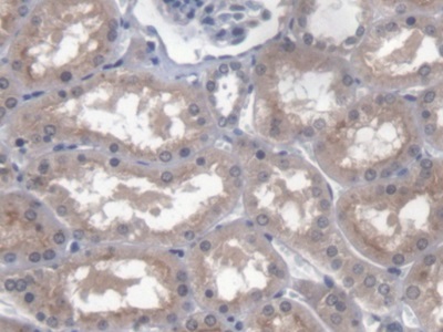 Polyclonal Antibody to Pituitary Tumor Transforming 1 Interacting Protein (PTTG1IP)