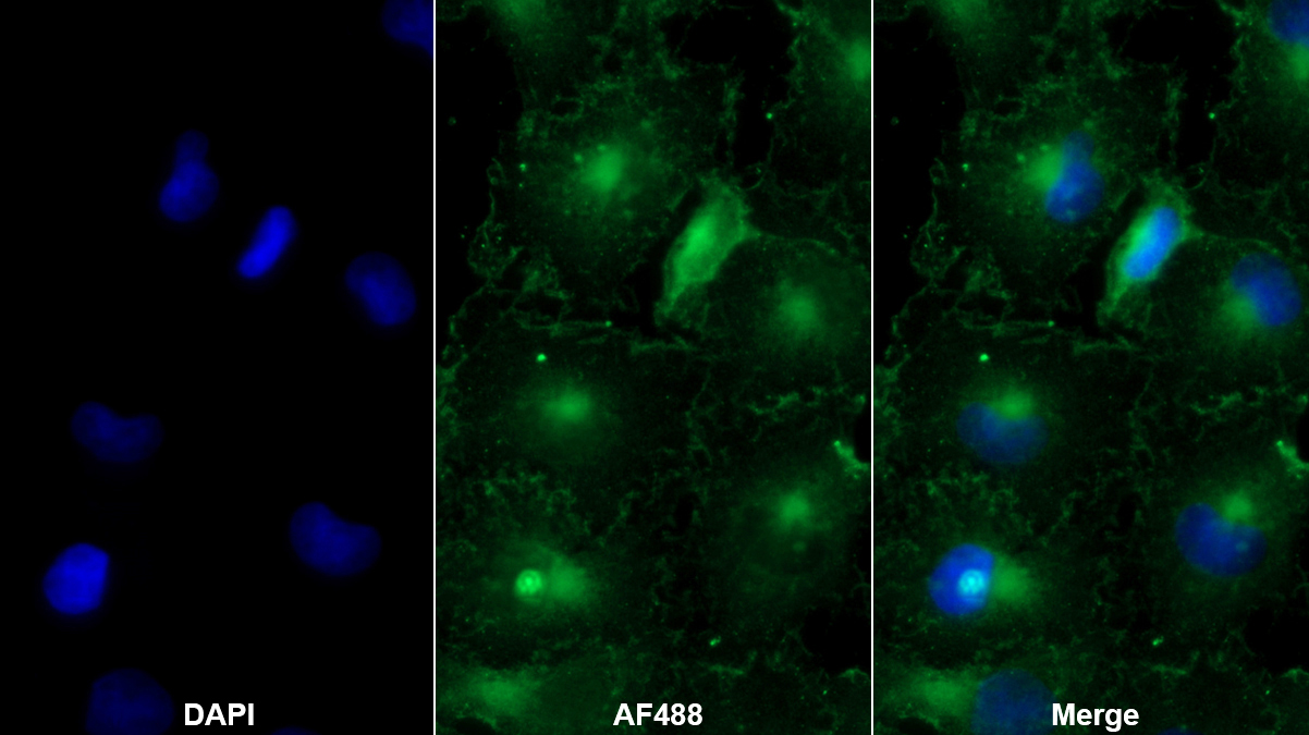 Polyclonal Antibody to Preferentially Expressed Antigen In Melanoma (PRAME)