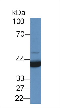 Polyclonal Antibody to Preferentially Expressed Antigen In Melanoma (PRAME)