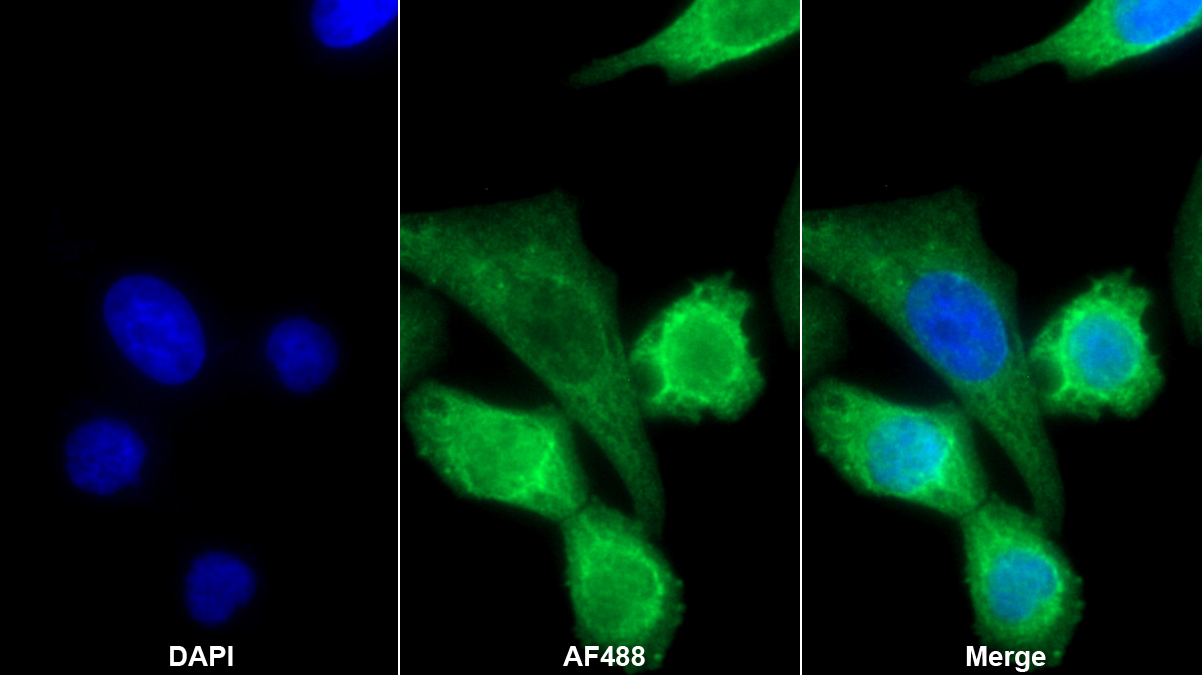 Polyclonal Antibody to Plastin 3 (PLS3)