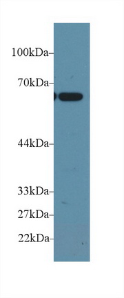 Polyclonal Antibody to Plastin 3 (PLS3)