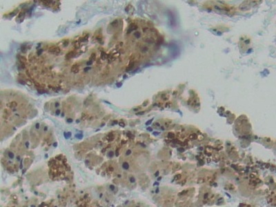 Polyclonal Antibody to Plastin 3 (PLS3)