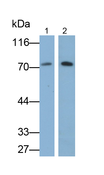 Polyclonal Antibody to Plastin 1 (PLS1)