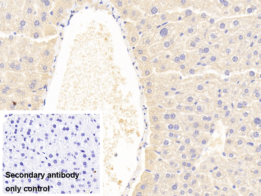 Polyclonal Antibody to Phosphohistidine Phosphatase 1 (PHPT1)