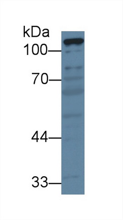 Polyclonal Antibody to Pyruvate Carboxylase (PC)