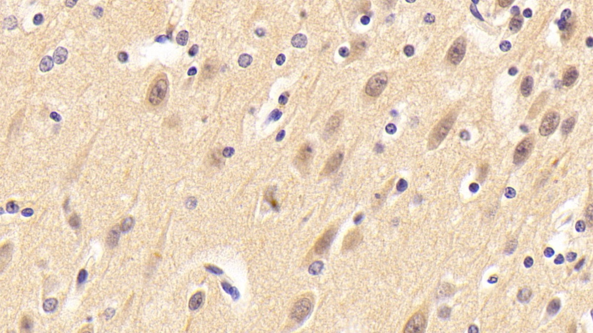 Polyclonal Antibody to Neuritin 1 (NRN1)