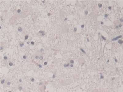 Polyclonal Antibody to Neudesin Neurotrophic Factor (NENF)