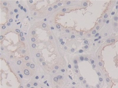 Polyclonal Antibody to Neudesin Neurotrophic Factor (NENF)