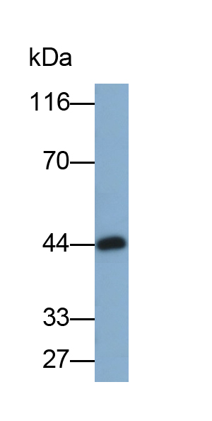 Polyclonal Antibody to N-Acetylgalactosaminidase Alpha (NAGa)