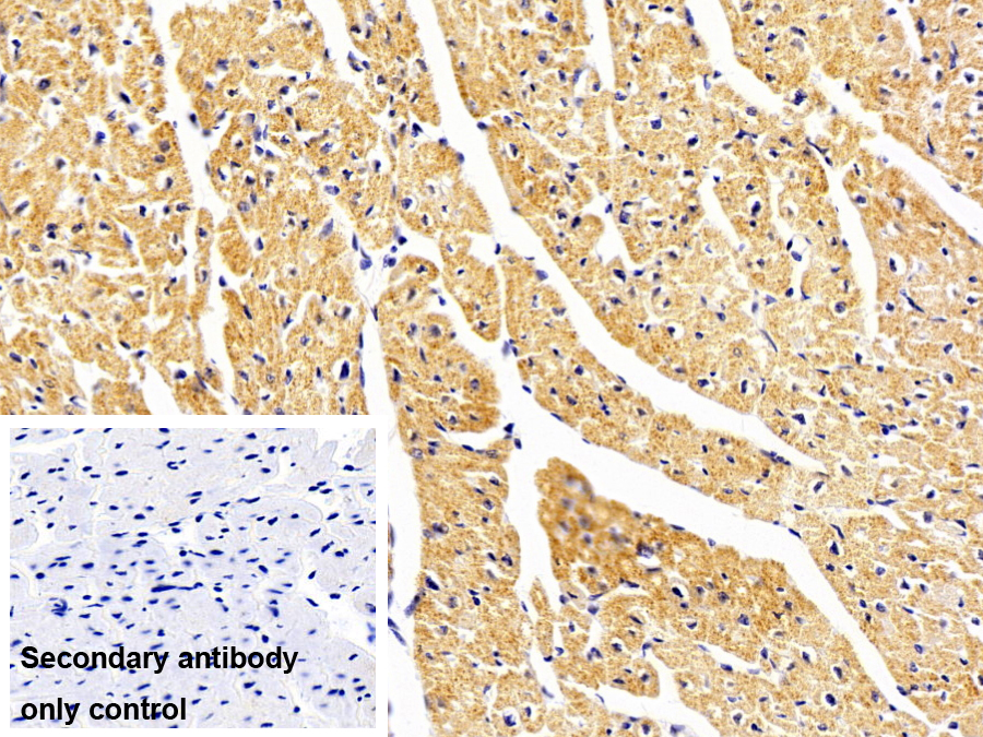 Polyclonal Antibody to N-Acetylgalactosaminidase Alpha (NAGa)