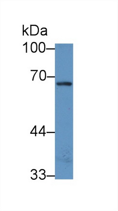 Polyclonal Antibody to NAD Kinase (NADK)