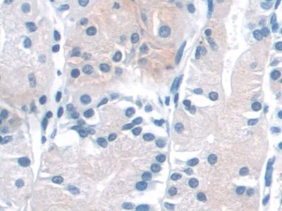 Polyclonal Antibody to NAD Kinase (NADK)