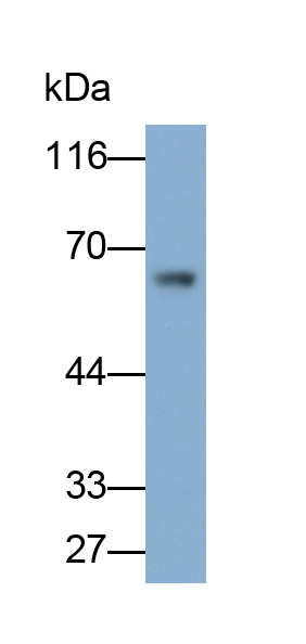 Polyclonal Antibody to NAD Kinase (NADK)