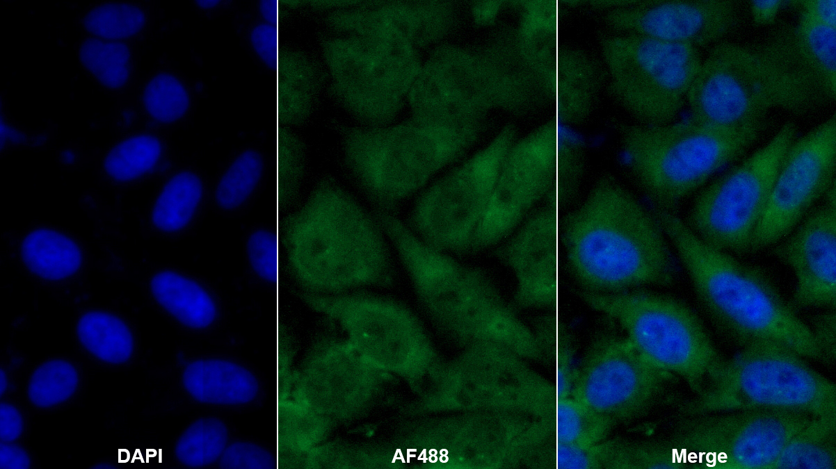 Polyclonal Antibody to Microphthalmia Associated Transcription Factor (MITF)