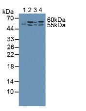 Polyclonal Antibody to Malic Enzyme 2, NADP+ Dependent, Mitochondrial (ME2)