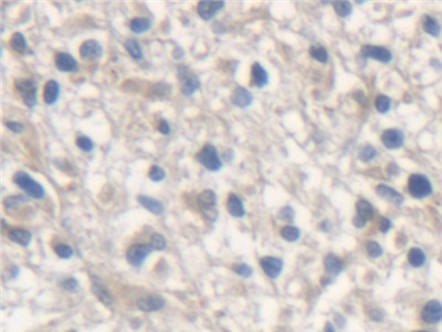 Polyclonal Antibody to Malic Enzyme 2, NADP+ Dependent, Mitochondrial (ME2)