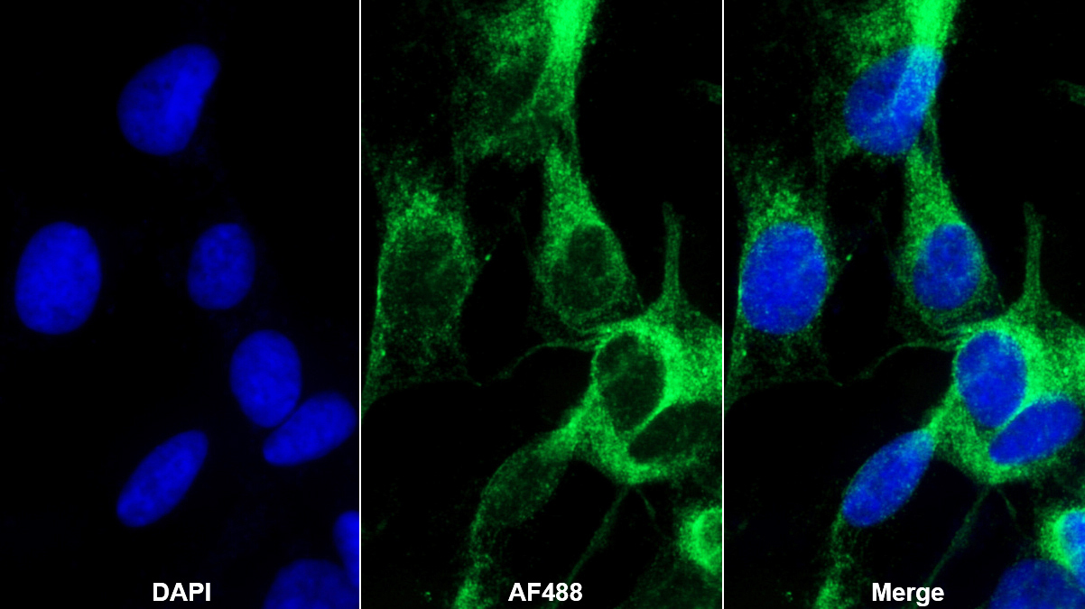 Polyclonal Antibody to Leucine Rich Repeat Kinase 2 (LRRK2)