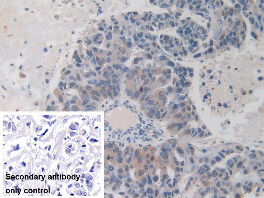 Polyclonal Antibody to Inter Alpha-Globulin Inhibitor H1 (ITIH1)