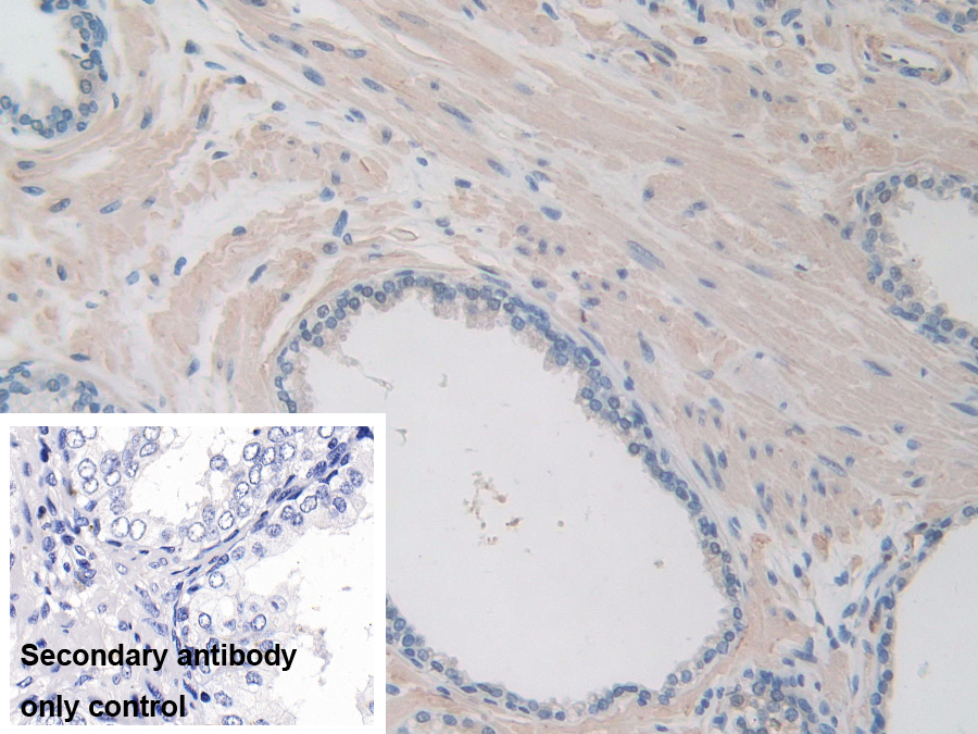 Polyclonal Antibody to Inter Alpha-Globulin Inhibitor H1 (ITIH1)