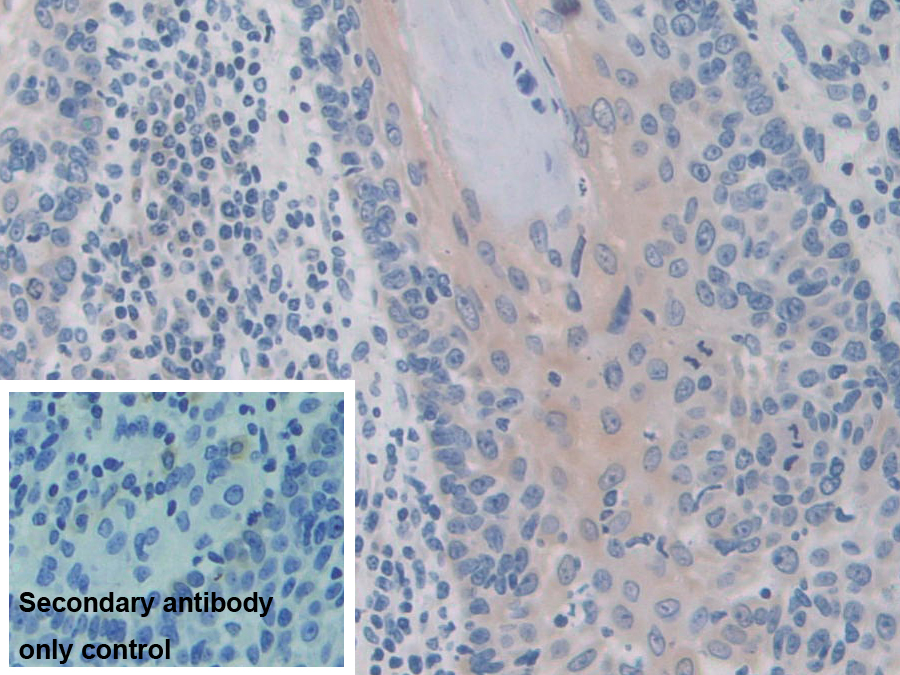 Polyclonal Antibody to Iron Responsive Element Binding Protein 2 (IREB2)