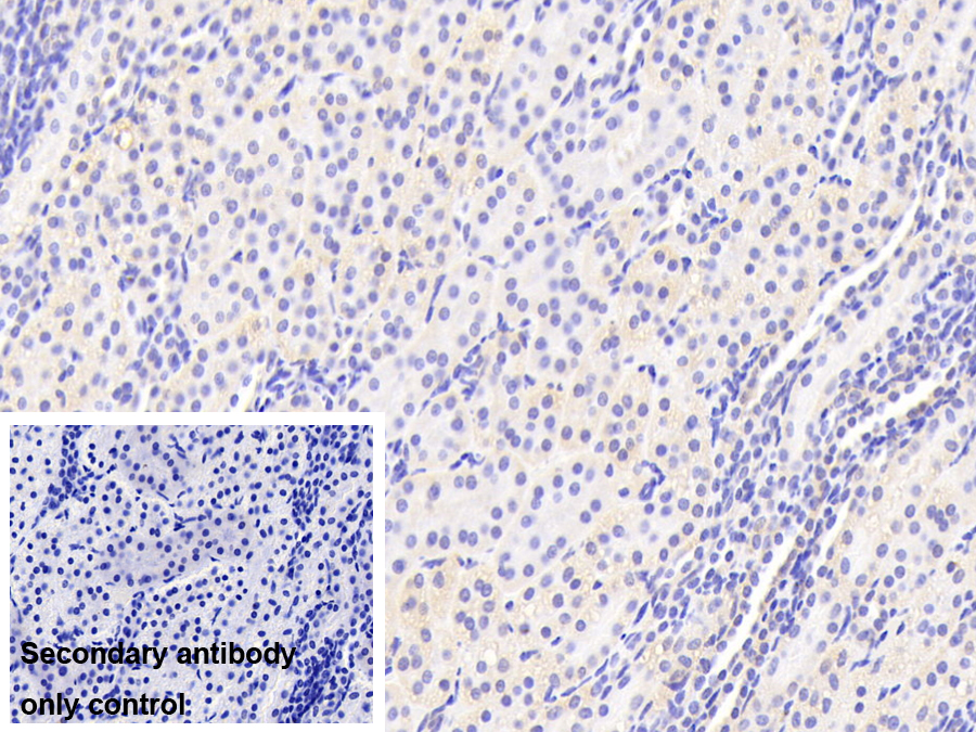 Polyclonal Antibody to Iron Responsive Element Binding Protein 2 (IREB2)