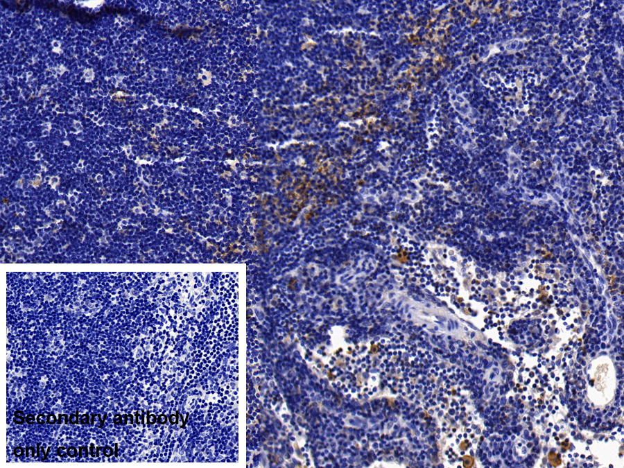 Polyclonal Antibody to Interleukin 1 Receptor Accessory Protein (IL1RAP)