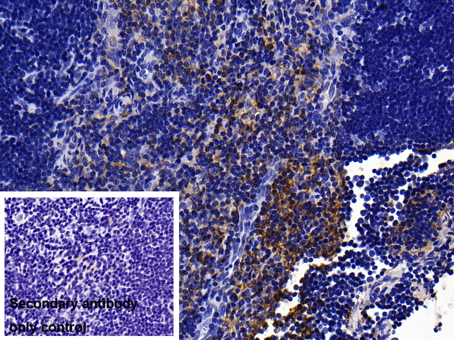 Polyclonal Antibody to Interleukin 1 Receptor Accessory Protein (IL1RAP)