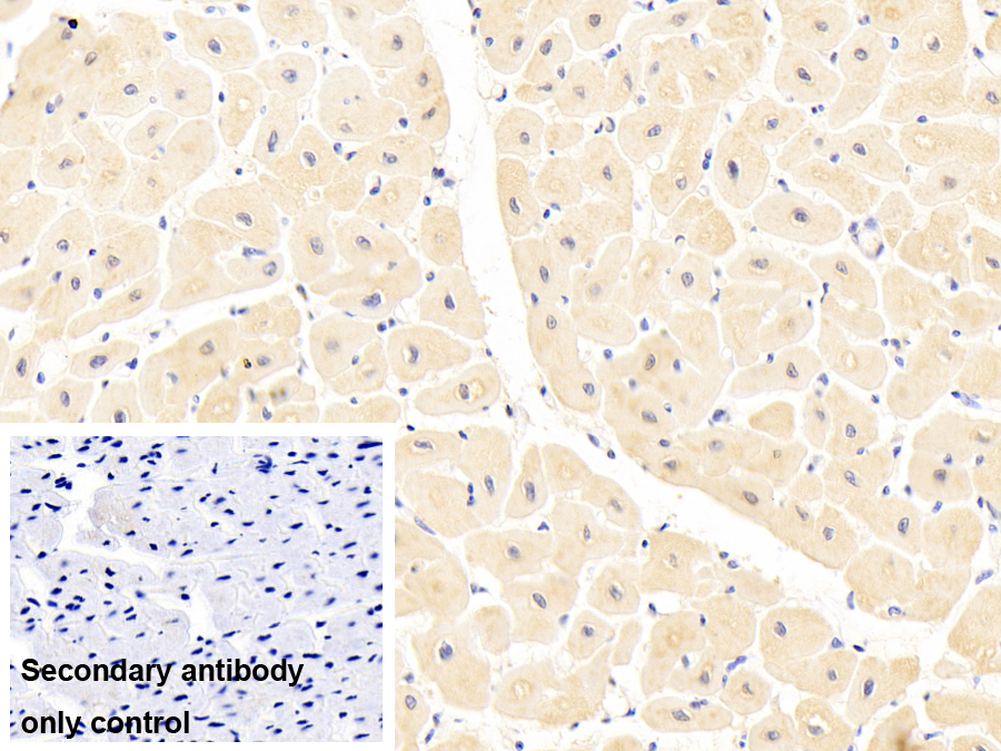 Polyclonal Antibody to Interleukin 1 Receptor Like Protein 1 (IL1RL1)