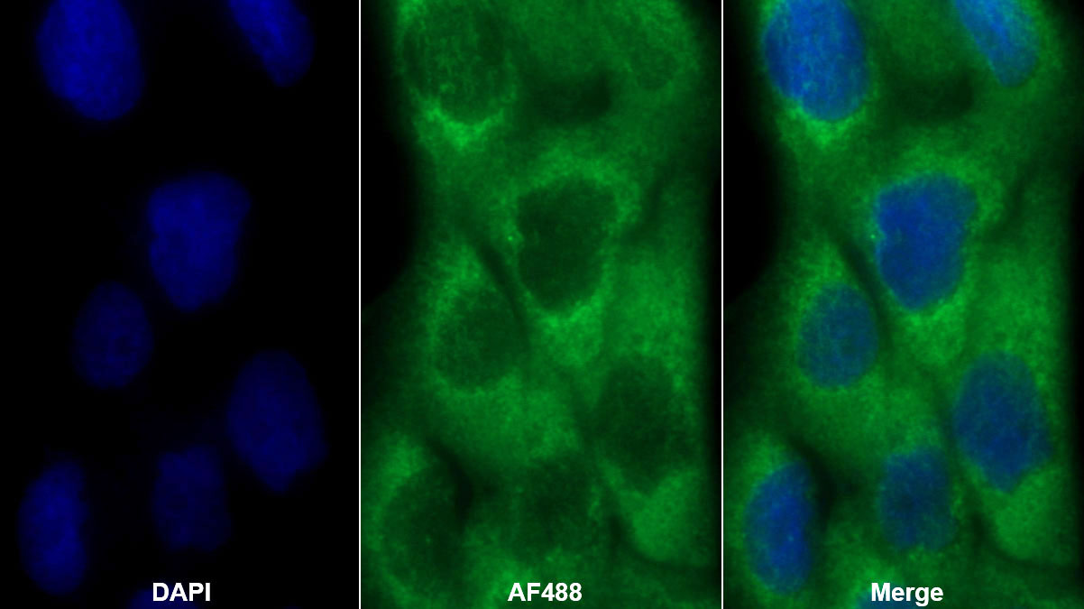 Polyclonal Antibody to Isocitrate Dehydrogenase 1, Soluble (IDH1)