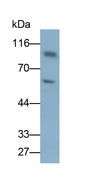 Polyclonal Antibody to T-Box Protein 3 (TBX3)