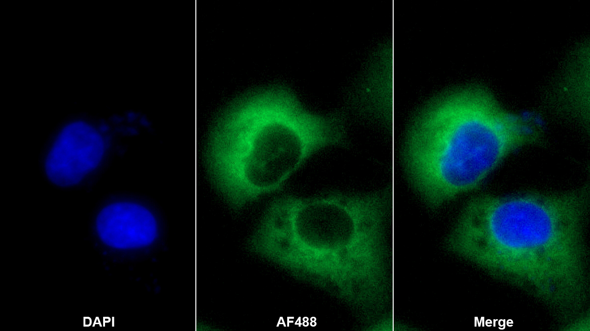 Polyclonal Antibody to Hornerin (HRNR)